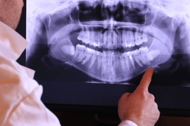 Best Pediatric Emergency Dentist in Groesbeck, OH