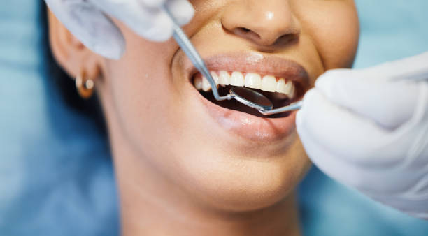 Best Emergency Dental Care for Abscessed Tooth in Groesbeck, OH