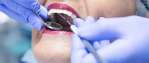 Best Emergency Dental Extractions in Groesbeck, OH